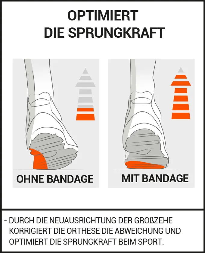 HALLUX VALGUS KORREKTURBANDAGE FÜR DEN SPORT