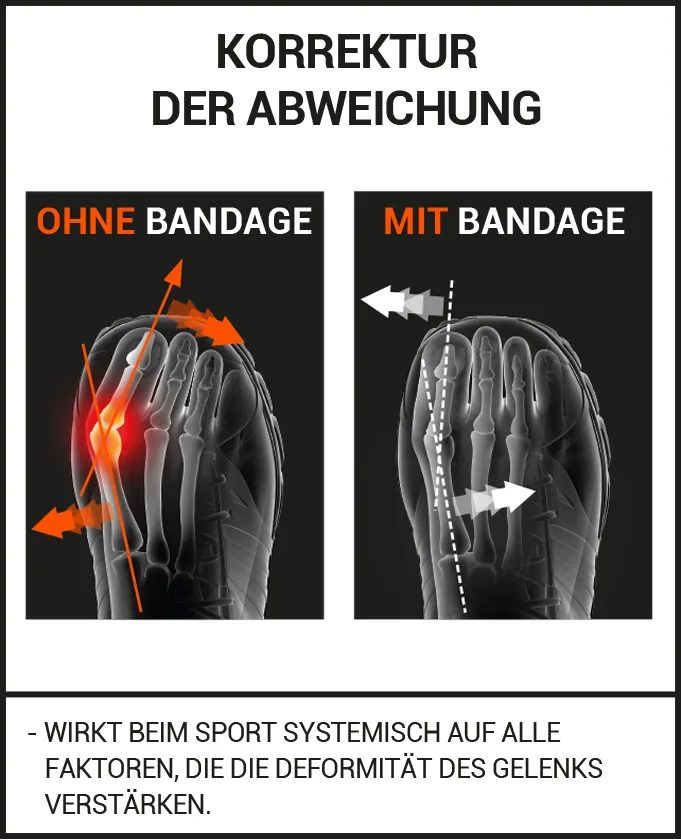 HALLUX VALGUS KORREKTURBANDAGE FÜR DEN SPORT