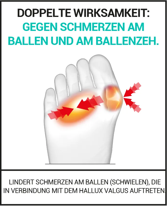 Hallux Valgus & fusßohlenschmerzen