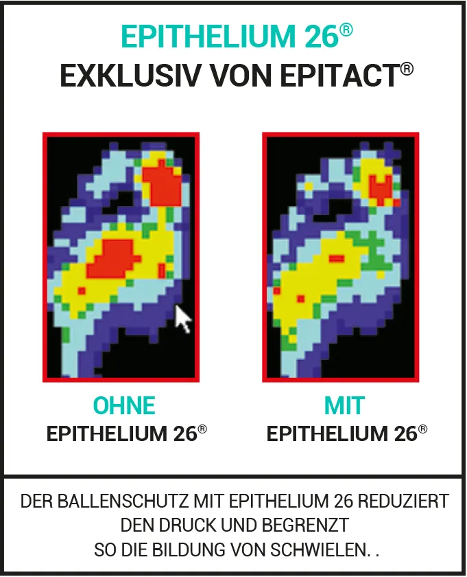 Hallux Valgus & fusßohlenschmerzen